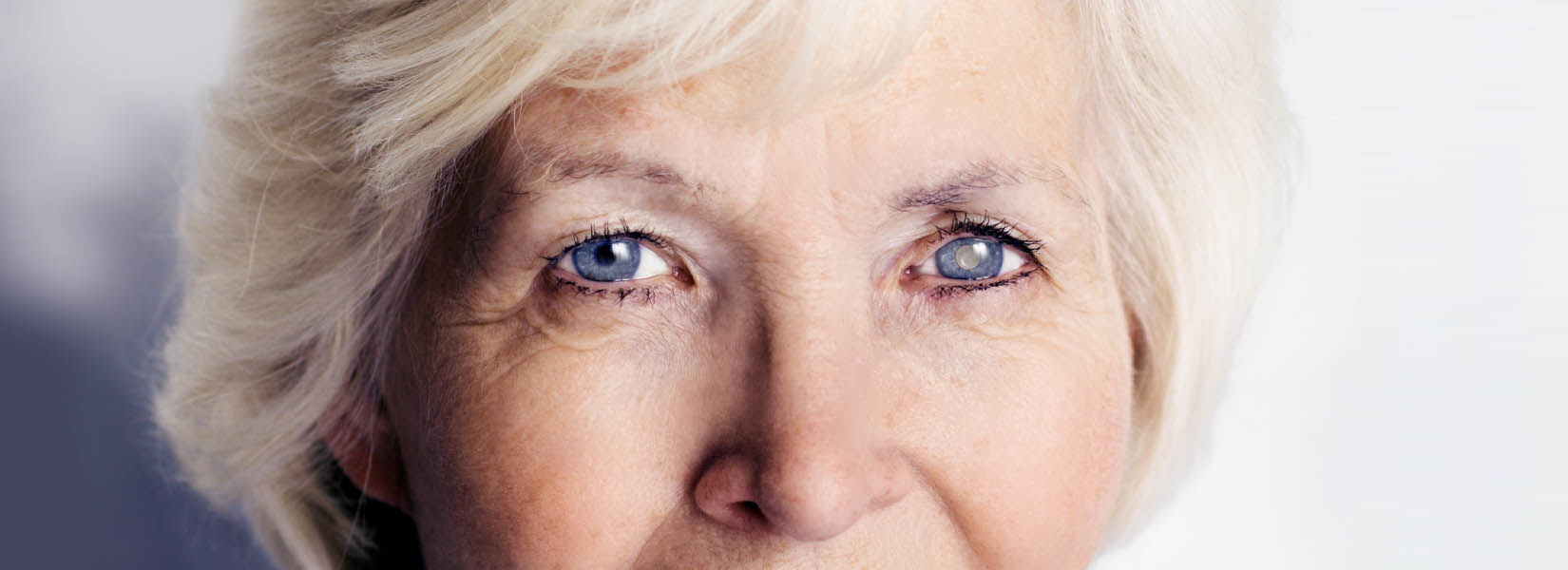 Cataract Surgery in Wexford